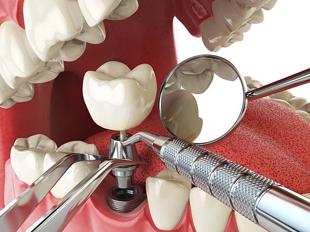 Best Root Canal Emergency Dentist  in Bayshe, OR